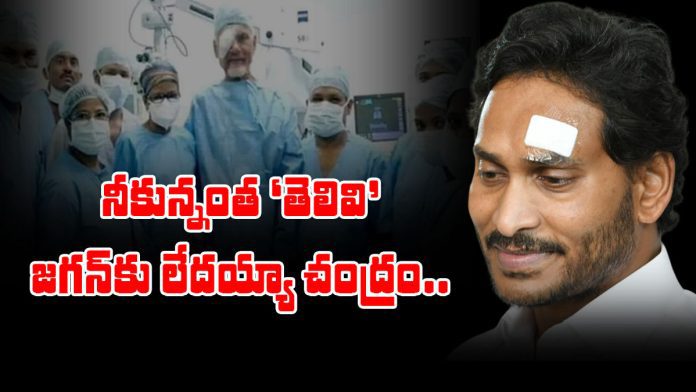 chandrababu has the ability to use everything to campaign for sympathy